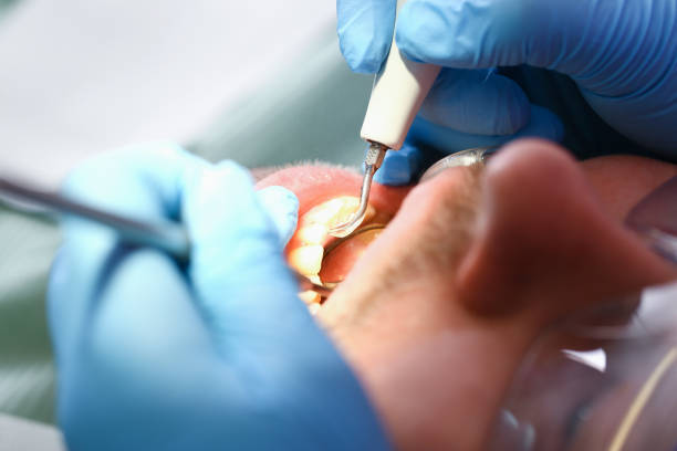 Best Walk-In Emergency Dentist in Anoka, MN